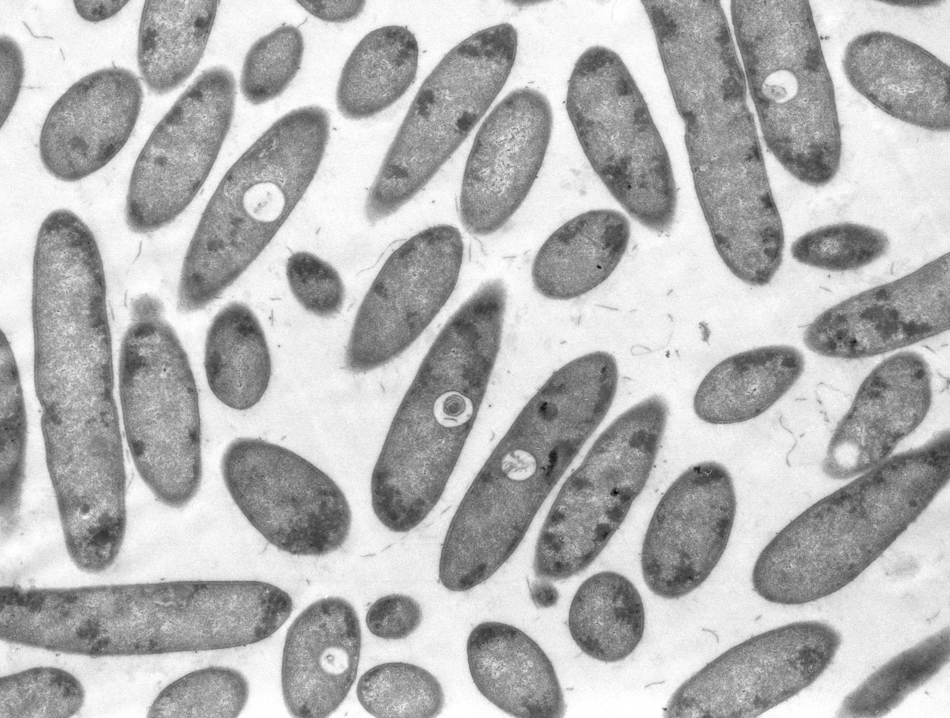 Экологический детокс: бактерии в Сибири чистят ядовитые отходы горнодобычи