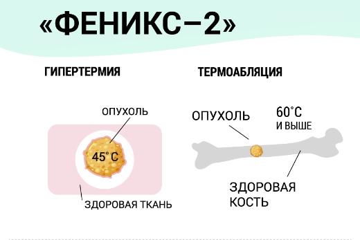 Томский «Феникс» позволяет лечить рак костей, не уменьшая их прочность