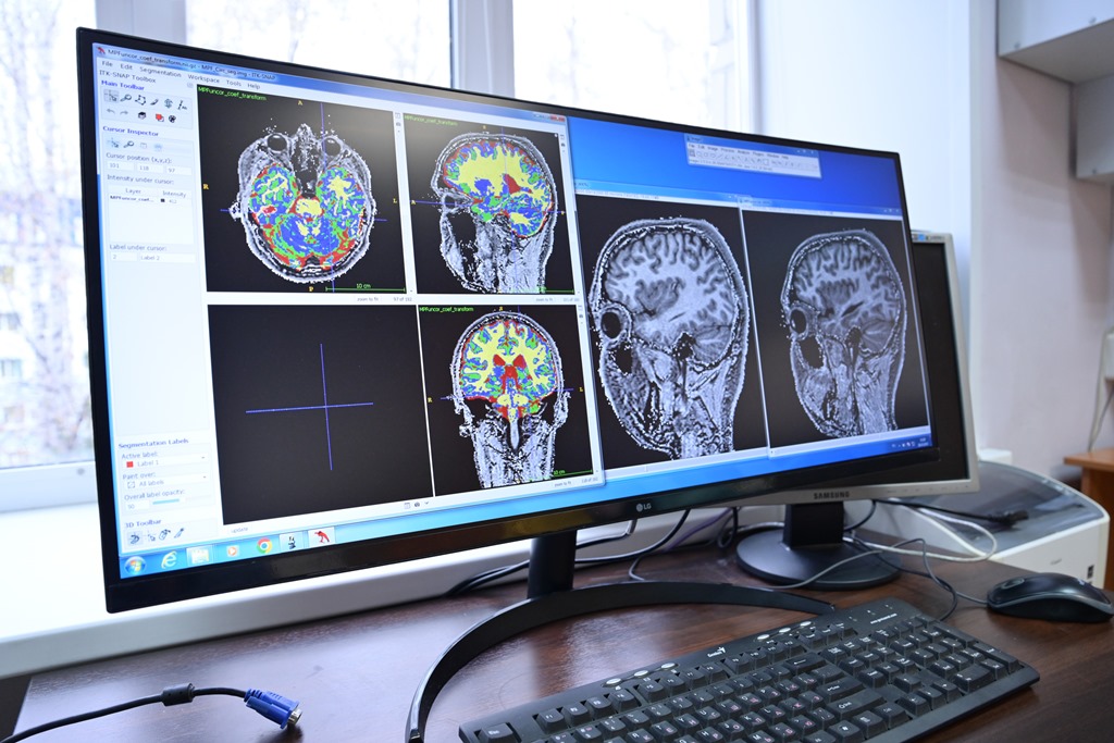 Нейробиологи ТГУ формируют «атлас» головного мозга человека