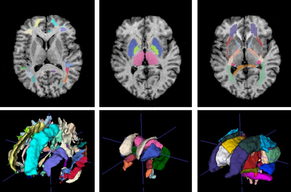 Учёные ТГУ выясняют, как ковид изменяет оболочки нервов головного мозга