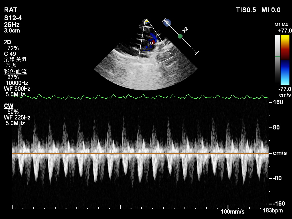УЗИ сердца у крысы.jpg