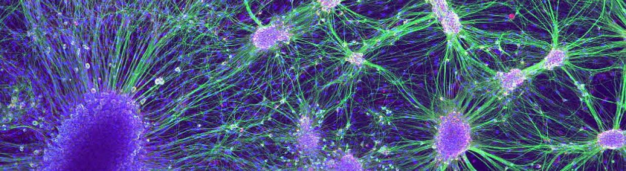 ТГУ подписал соглашение с Отраслевым союзом «Нейронет»