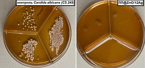 Томские ученые создали первую в РФ антимикробную ПП-пленку для продуктов