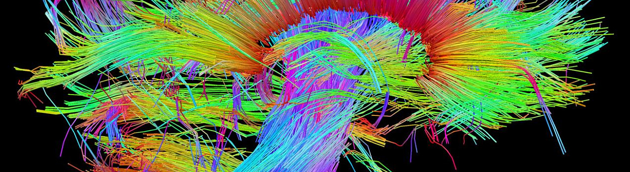 Связи решают всё: что происходит в голове, когда человек учится